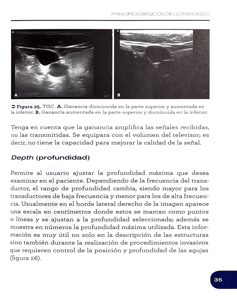 Principios Básicos de Ultrasonido 1. Serie: Ultrasonido Focalizado en Urgencias y Cuidado Crítico