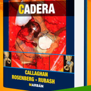 Cadera Callaghan