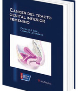 Cáncer del Tracto Genital Inferior Femenino