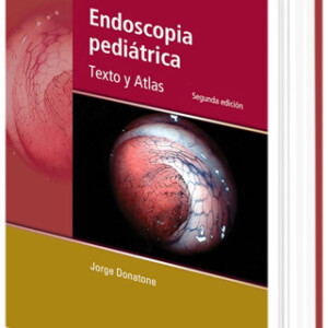 Endoscopia Pediátrica
