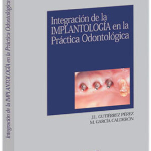 Integración de la Implantología en la Práctica Odontológica