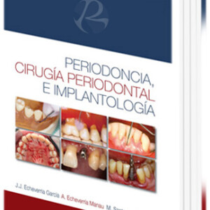 Periodoncia, Cirugía Periodontal e Implantología