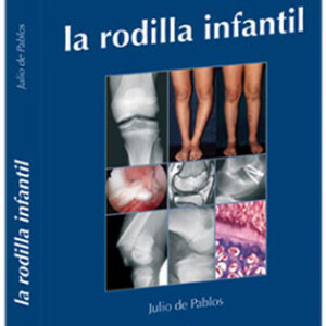La Rodilla Infantil