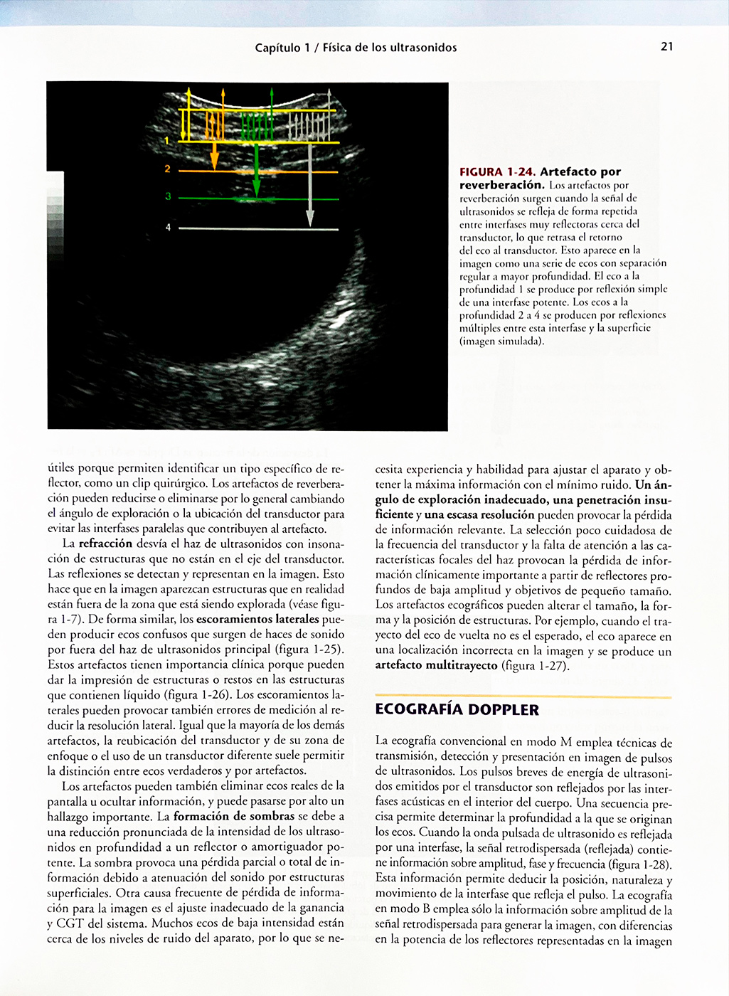 Eco Doppler Transnucal En Que Semana Se Hace Ecografía Morfológica